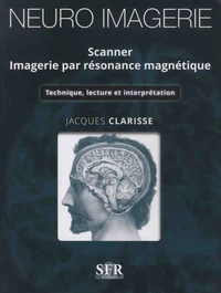 Neuro imagerie - Scanner - Imagerie par résonance magnétique