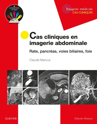 Claude Marcus - Cas cliniques en imagerie abdominale - Rate, pancréas, voies biliaires, foie.