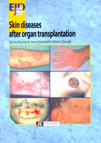 Skin diseases after organ transplatation