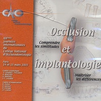 CNO - Occlusion et implantologie - Comprendre les similitudes, Maîtriser les différences, CD-Rom.