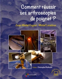 Comment réussir ses arthroscopies de poignet ?