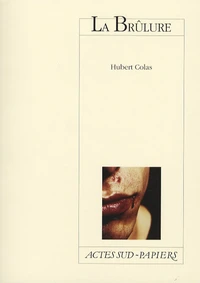 La Brûlure