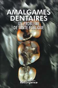 Amalgames Dentaires. Un Probleme De Sante Publique