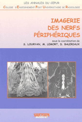 Marc Lemort - Imagerie des nerfs périphériques.