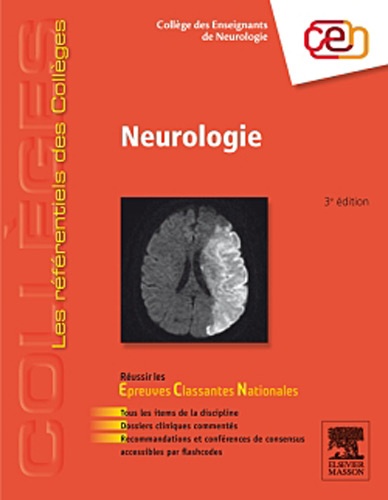 Neurologie 3e édition