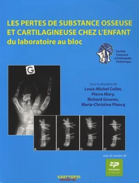 Les pertes de substance osseuse et cartilagineuse chez l'enfant