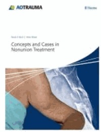 Concepts and Cases in Nonunion Treatment.