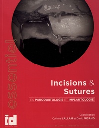 Corinne Lallam et David Nisand - Incisions & sutures en parodontolologie et implantologie.