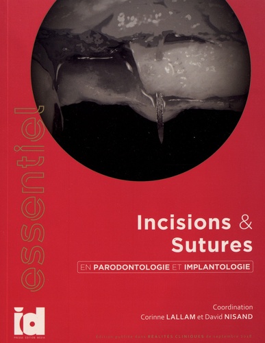 Incisions & sutures en parodontolologie et implantologie