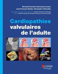 Cardiopathies valvulaires de l'adulte