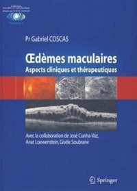 OEdèmes maculaires