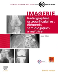 Radiographies ostéoarticulaires