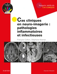 Cas cliniques en neuro-imagerie