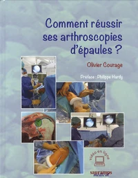 Comment réussir ses arthroscopies d'épaules ?
