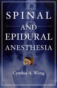 Cynthia Wong - Spinal and Epidural Anesthesia.