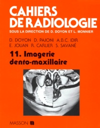 D Doyon et  Collectif - Cahiers de radiologie Tome 11 - Imagerie dento-maxillaire.