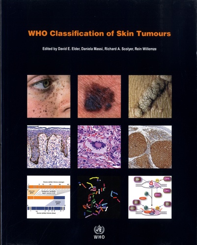 Who Classification of Skin Tumours