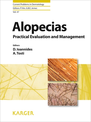 D Ioannides et Antonella Tosti - Alopecias - Practical Evaluation and Management.