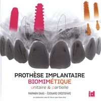 Prothèse implantaire biomimétique unitaire et partielle