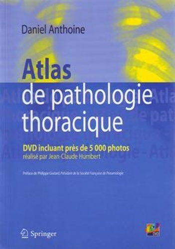 Daniel Anthoine - Atlas de pathologie thoracique.