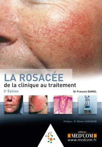 La rosacée