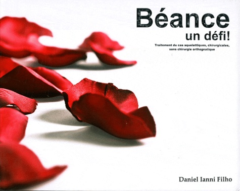 Daniel Ianni Filho - Béance : un défi ! - Traitement du cas squelettiques, chirurgicales, sans chirurgie orthognatique.
