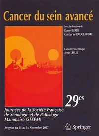 Cancer du sein avancé