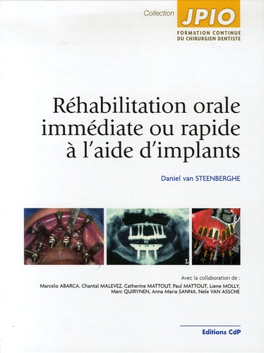 Daniel van Steenberghe - Réhabilitation orale immédiate ou rapide à l'aide d'implants.