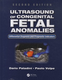 Dario Paladini et Paolo Volpe - Ultrasound of Congenital Fetal Anomalies - Differential Diagnosis and Prognostic Indicators.