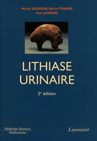 Lithiase urinaire