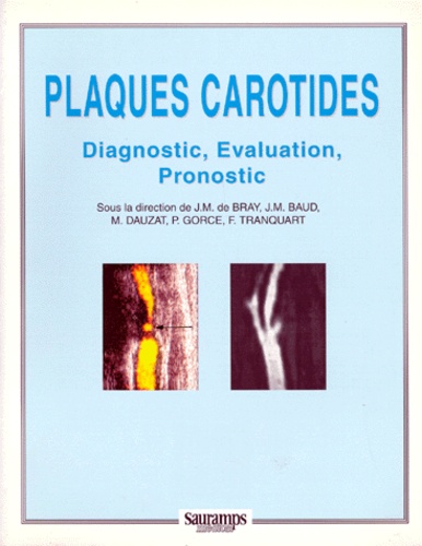  Dauzat - Plaques Carotides. Diagnostic, Evaluation, Pronostic.