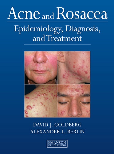 David J Goldberg - Acne and Rosacea - Epidemiology, Diagnosis and Treatment.