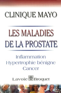 David-M Barrett - Les Maladies De La Prostate. Inflammation, Hypertrophie Benigne, Cancer.