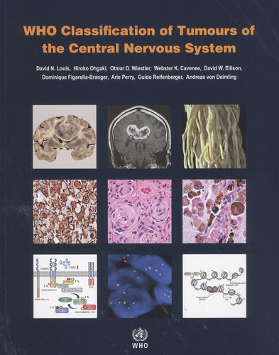 David-N Louis et Hiroko Ohgaki - WHO Classification of Tumours of the Central Nervous System.