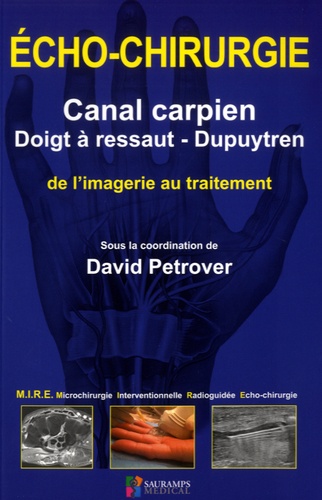 David Petrover - Echo-chirurgie canal carpien, doigt à ressaut - Dupuytren - De l'imagerie au traitement.