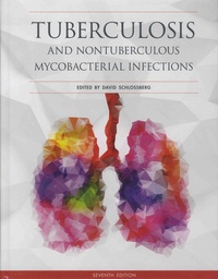 David Schlossberg - Tuberculosis and Nontuberculous Mycobacterial Infections.