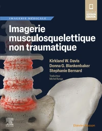 Imagerie musculosquelettique non traumatique