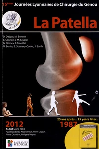 La Patella