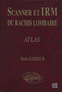 Denis Gardeur - Scanner et IRM du rachis lombaire.