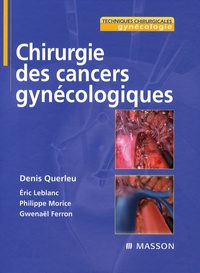 Denis Querleu - Chirurgie des cancers gynécologiques.