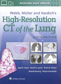 Webb, Müller and Naidich's High-Resolution CT of the Lung