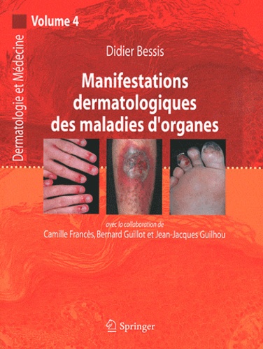 Didier Bessis - Manifestations dermatologiques des maladies d'organes.