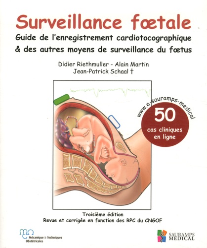 Didier Riethmuller et Alain Martin - Surveillance foetale - Guide de l'enregistrement cardiotocographique & des autres moyens de surveillance du foetus.