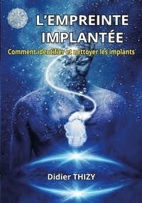 Didier Thizy - L'empreinte implantée - Comment identifier et nettoyer les implants.