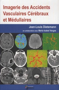 Imagerie des accidents vasculaires cérébraux et médullaires