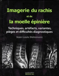 Imagerie du rachis et de la moelle épinière