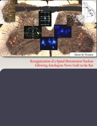 Dieter M. Weinert - Reorganization of  a Spinal Motoneuron Nucleus following Autologous Nerve Graft in the Rat.