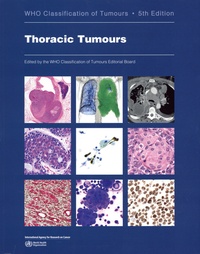 Dilani Lokuhetty et Valerie A. White - Thoracic Tumours - WHO Classification of Tumours Editorial Board.