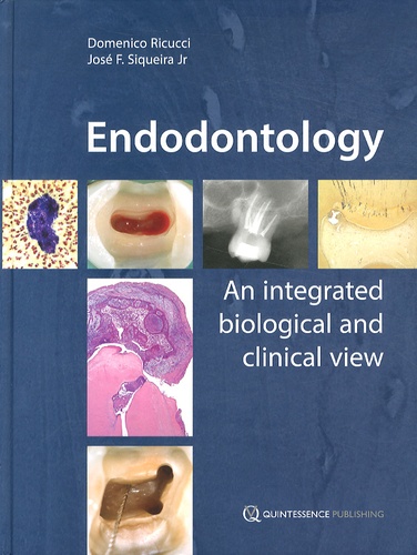 Domenico Ricucci et José Siqueira - Endodontology - An integrated biological and clinical view.