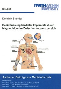 Dominik Stunder - Beeinflussung kardialer Implantate durch Magnetfelder im Zwischenfrequenzbereich.